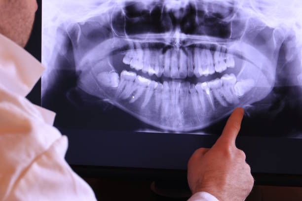 Best Broken or Chipped Tooth Repair in Potomac Heights, MD