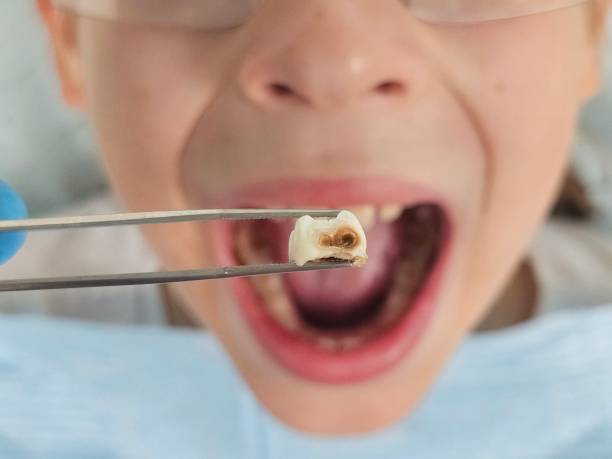 Best Emergency Treatment for Jaw Pain or Injury in Potomac Heights, MD